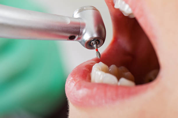 Best Emergency Treatment for Oral Infections in Newton, KS